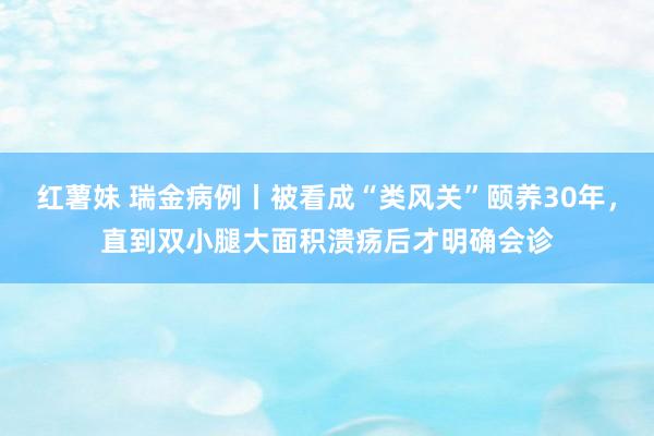 红薯妹 瑞金病例丨被看成“类风关”颐养30年，直到双小腿大面积溃疡后才明确会诊